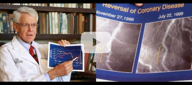 [Vidéo] Interview du Docteur Caldwell B. Esselstyn : Prévenir et enrayer les maladies cardiaques