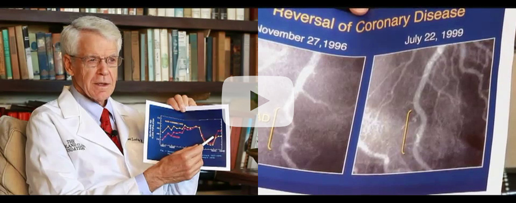 [Vidéo] Interview du Docteur Caldwell B. Esselstyn : Prévenir et enrayer les maladies cardiaques
